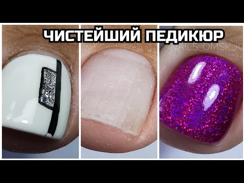 Видео: ЧИСТЕЙШИЙ ПЕДИКЮР💣ОБРАБОТКА ПАЛЬЧИКОВ 🔥Фуксия♥️Как сделать педикюр чистым⁉️мои материалы👍