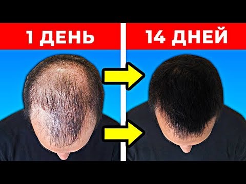 Видео: 10 Способов Как Быстро Отрастить Волосы