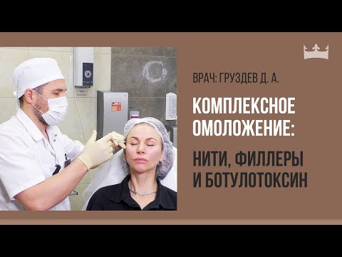 Видео: Комплексное омоложение лица: нити, филлеры и ботулотоксин