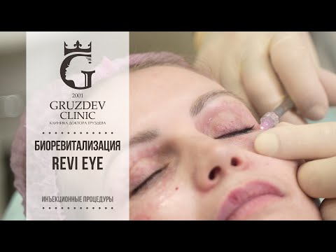 Видео: Как убрать морщины вокруг глаз