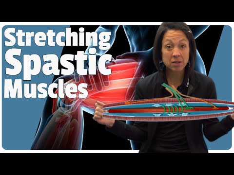Видео: Преодоление спастичности ноги: что работает