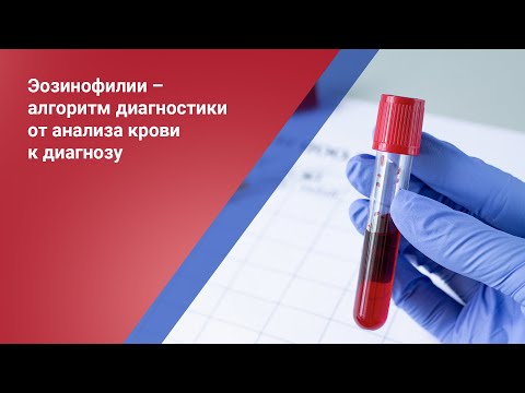 Видео: Эозинофилии – алгоритм диагностики от анализа крови к диагнозу