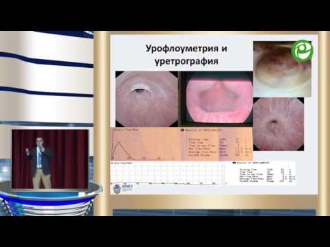 Видео: Живов А В - Принятие решений в хирургии стриктур уретры, что важно знать всем