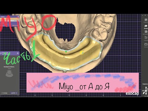 Видео: Miyo от А до Я. Моделирование зубов. Жидкая керамика. Exocad.