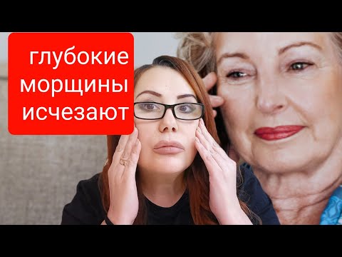 Видео: Всего 1 раз в день! Глубокие морщины исчезают! Простой домашний крем от морщин.