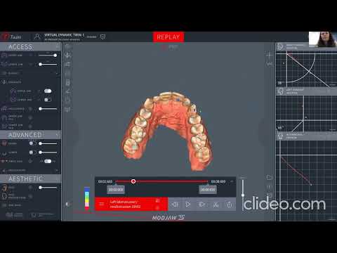 Видео: Функціональна діагностика пацієнта та співставлення даних з Modjaw в Exocad