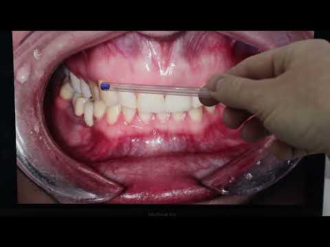 Видео: Стомбудни#16 ЛЕЧИМ ЩЕЛЧКИ В СУСТАВЕ!