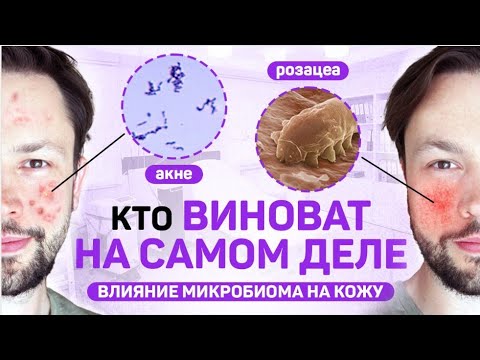 Видео: Пробиотики в косметике. Как микробиом влияет на кожу?