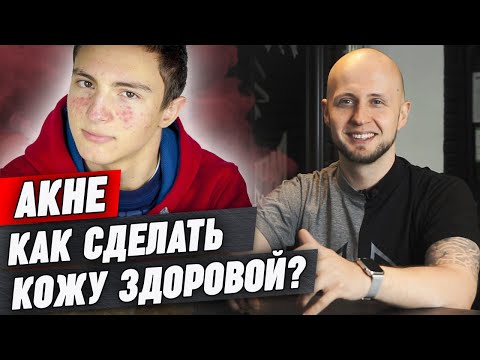 Видео: Что такое акне? Причины возникновения акне / Как избавиться от прыщей?