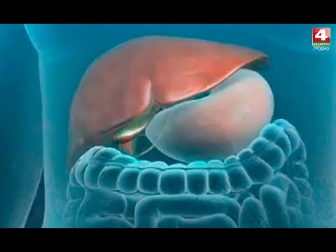 Видео: Вопрос здоровья. Желчекаменная болезнь. 04.05.2020