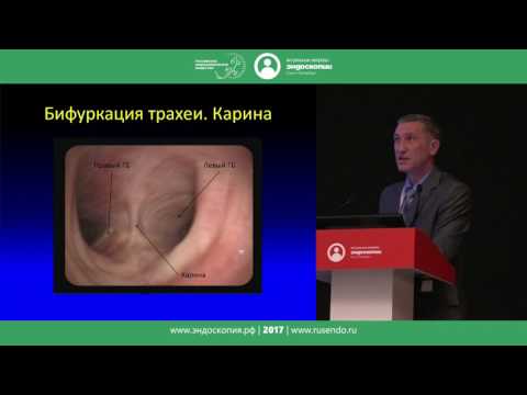 Видео: Анестезия и методика осмотра бронхиального дерева