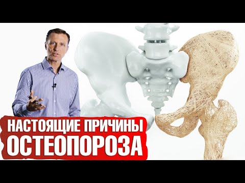 Видео: Причины остеопороза не в дефиците кальция📢Прием кальция опасен