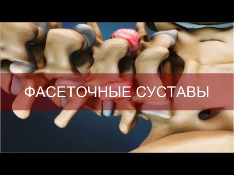 Видео: Фасеточные суставы