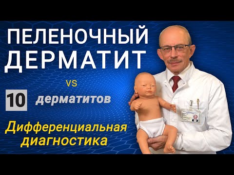 Видео: Пеленочный дерматит у новорожденных - дифференциальная диагностика, лечение, симптомы, причины, мазь