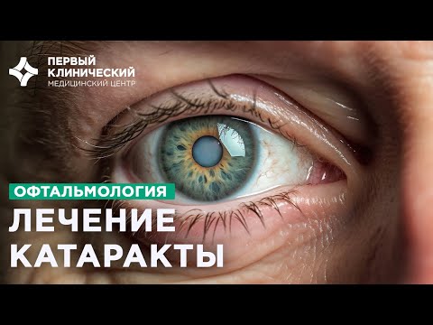 Видео: Катаракта: просто о сложном