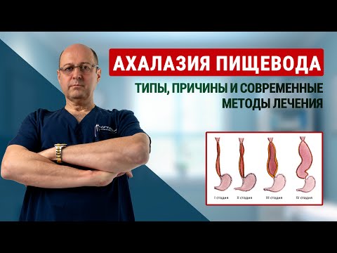 Видео: Ахалазия пищевода: типы, причины и современные методы лечения | доктор Юрий Гольдес