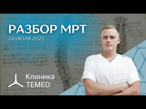 Видео: Разбор МРТ (24.07.23)