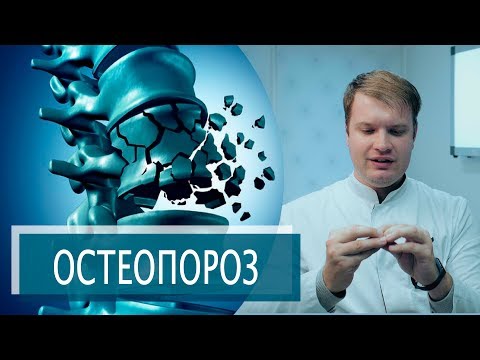 Видео: ХРУПКИЕ КОСТИ | ОСТЕОПОРОЗ, ОСТЕОПЕНИЯ