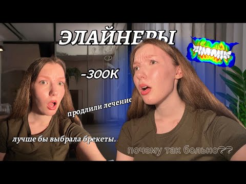 Видео: ВСЯ ПРАВДА об элайнерах | Стоит ли оно того? Мой честный опыт
