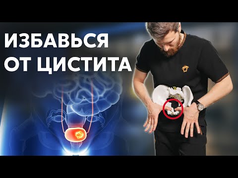 Видео: ЦИСТИТ: как избавиться? Лечение в домашних условиях