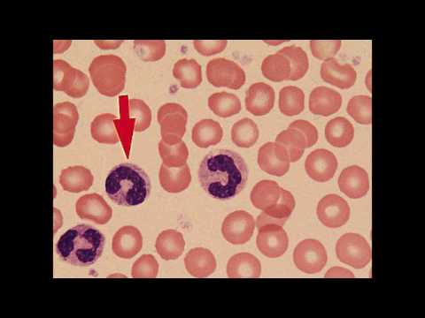 Видео: Кровь.