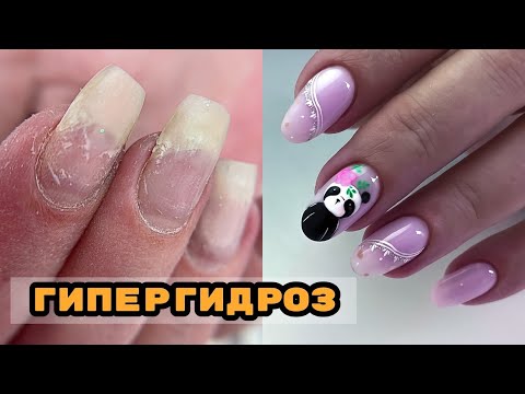 Видео: ГИПЕРГИДРОЗ 🥺 Как с этим работать? 💅 Маникюр с весенними гелями Si