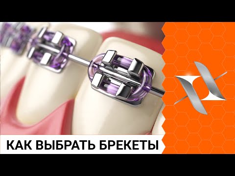 Видео: Как выбрать БРЕКЕТЫ и не прогадать? (Осознанный выбор)