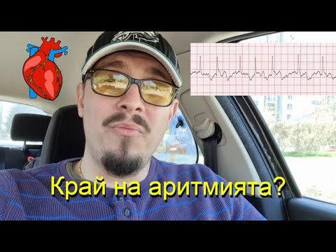 Видео: Борбата с ритъмните нарушения | Крио Аблация| Катетърна аблация | Аритмии | Предсърдно мъждене