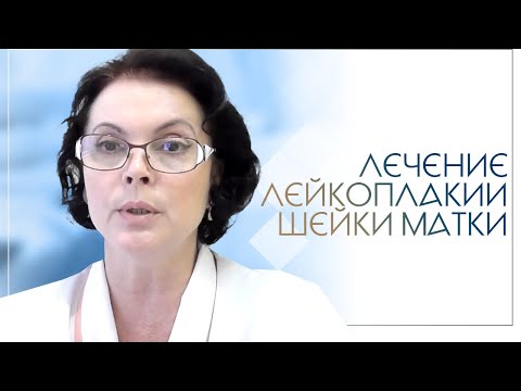 Видео: Лечение лейкоплакии шейки матки