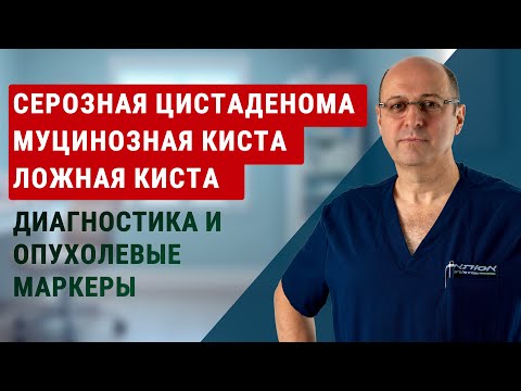 Видео: Ложная киста, серозная цистаденома, муцинозная киста: диагностика, опухолевые маркеры | Юрий Гольдес