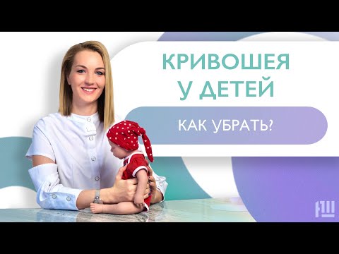 Видео: Кривошея у ДЕТЕЙ/ Что делать? Как убрать?
