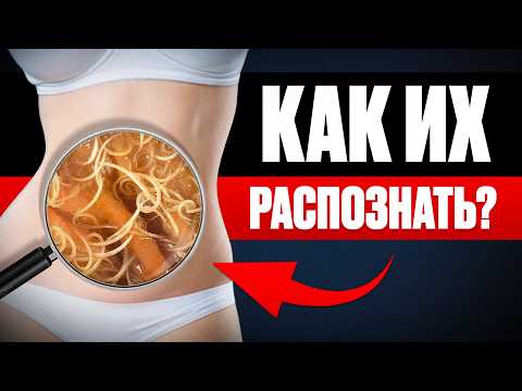 Видео: 10 ПРИЗНАКОВ НАЛИЧИЯ ПАРАЗИТОВ, и как от них избавиться без таблеток