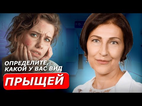 Видео: ВЫДАВЛИВАНИЕ ЭТИХ ПРЫЩЕЙ СТРОГО ЗАПРЕЩЕНО! Все что нужно знать о прыщах: виды, лечение, причины