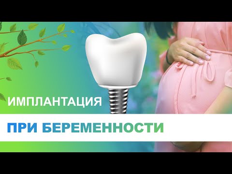 Видео: 🤰 Имплантация зубов при беременности - возможно ли?