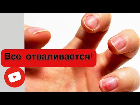 Видео: УКРЕПЛЕНИЕ коротких НОГТЕЙ | ГЕЛЕВОЕ покрытие.