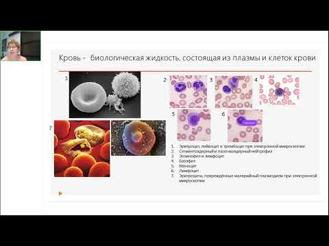 Видео: Хронический лимфолейкоз (ХЛЛ). Онлайн-школа 19.11.2022