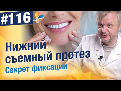 Видео: Съёмный протез постоянно шатается? Вот что реально помогает!