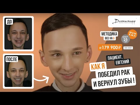 Видео: КАК Я ПОБЕДИЛ РАК? И вернул зубы⭐️+7 (495) 255-59-37 😍Евгений, 25 лет. Видеоотзыв.