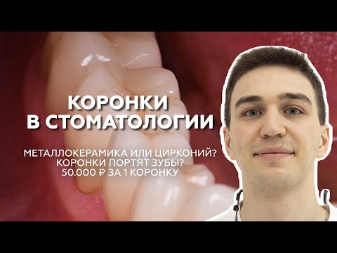 Видео: Коронки в стоматологии: металлокерамика или цирконий?