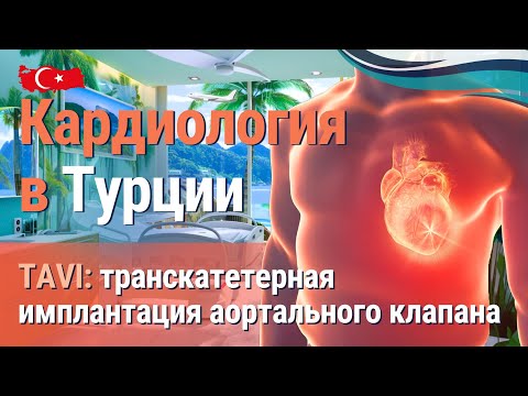 Видео: Кардиология и лечение сердца в Турции. Имплантация аортального клапана малоинвазивным методом TAVI.