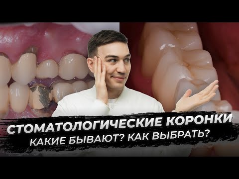 Видео: Коронки в стоматологии: металлокерамика, цирконий и керамика