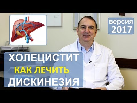 Видео: ХОЛЕЦИСТИТ, лечение. ДИСКИНЕЗИЯ желчного пузыря: КАК ЛЕЧИТЬ без лекарств.