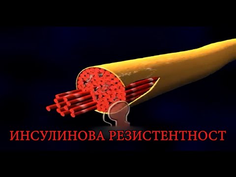 Видео: ИНСУЛИНОВА РЕЗИСТЕНТНОСТ – КАКВО ТРЯБВА ДА ЗНАЕМ?