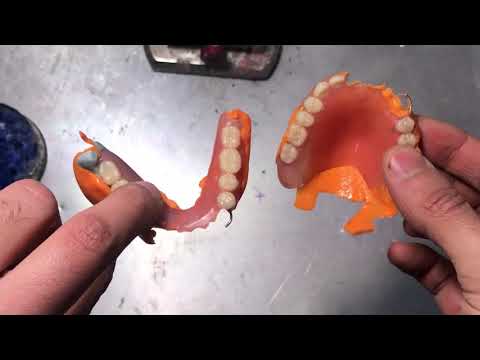 Видео: Съемный протез перебазировка