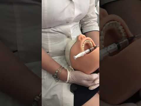 Видео: Анестезии в стоматологии (2) , OSCE-1