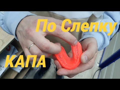 Видео: Спортивная капа на заказ
