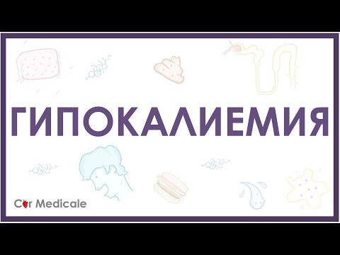 Видео: Гипокалиемия - причины, механизм развития, последствия, принципы устранения