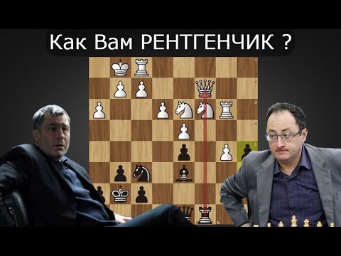 Видео: Иванчук ПРОСВЕТИЛ ☢ РЕНТГЕНОМ королеву Гельфанда! Шахматы