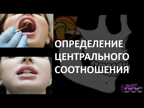Видео: ОПРЕДЕЛЕНИЕ ЦЕНТРАЛЬНОГО СООТНОШЕНИЯ живая демонстрация