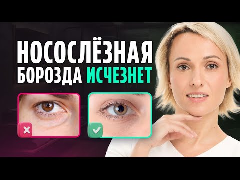 Видео: Эти 2 приема БЫСТРО убирают НОСОСЛЕЗНУЮ БОРОЗДУ / Результат вас удивит!